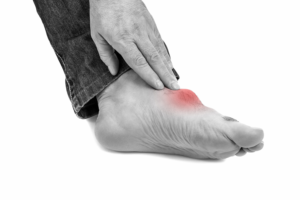 What Is Gout